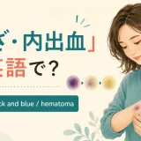 あざ・内出血を英語で表すbruise・black and blue・hematomaの解説