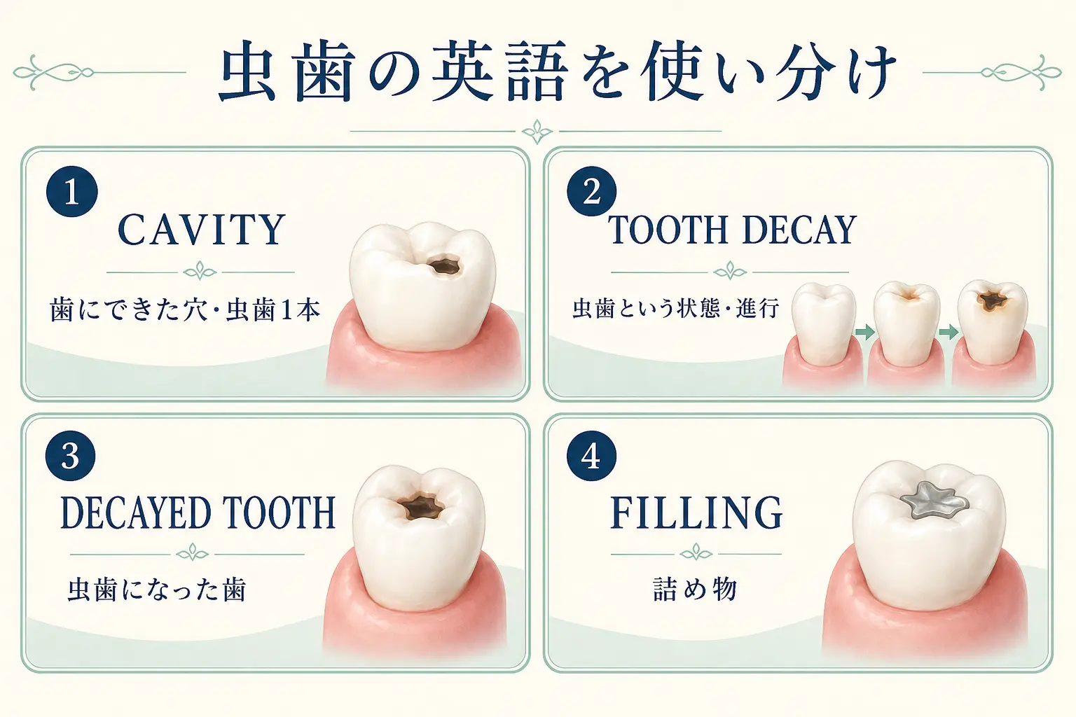 cavity・tooth decay・decayed tooth・fillingの違いを示す図