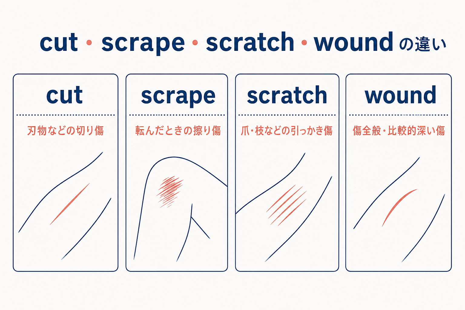 cutは切り傷、scrapeは擦り傷、scratchは引っかき傷、woundは傷全般を表す比較図