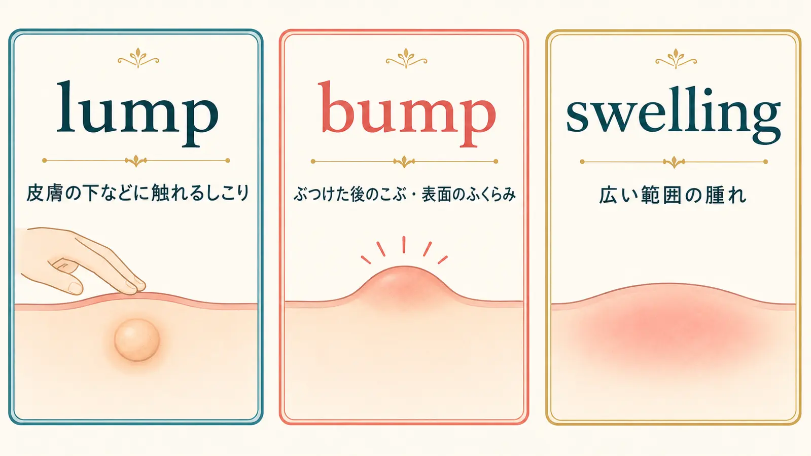 lumpは触れるしこり、bumpは表面のこぶ、swellingは広い範囲の腫れという違い