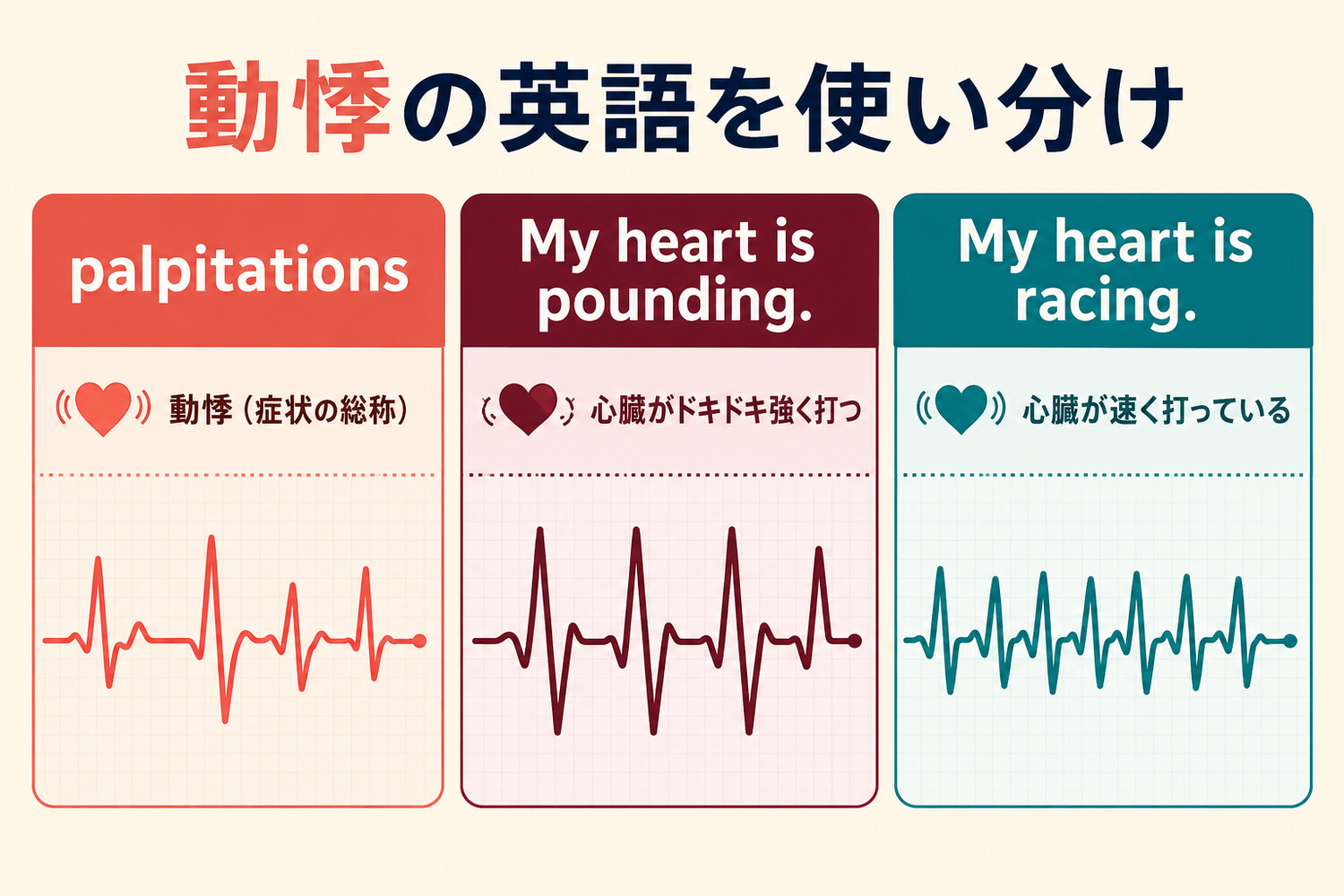 palpitations・My heart is pounding・My heart is racingの違いを示す比較図