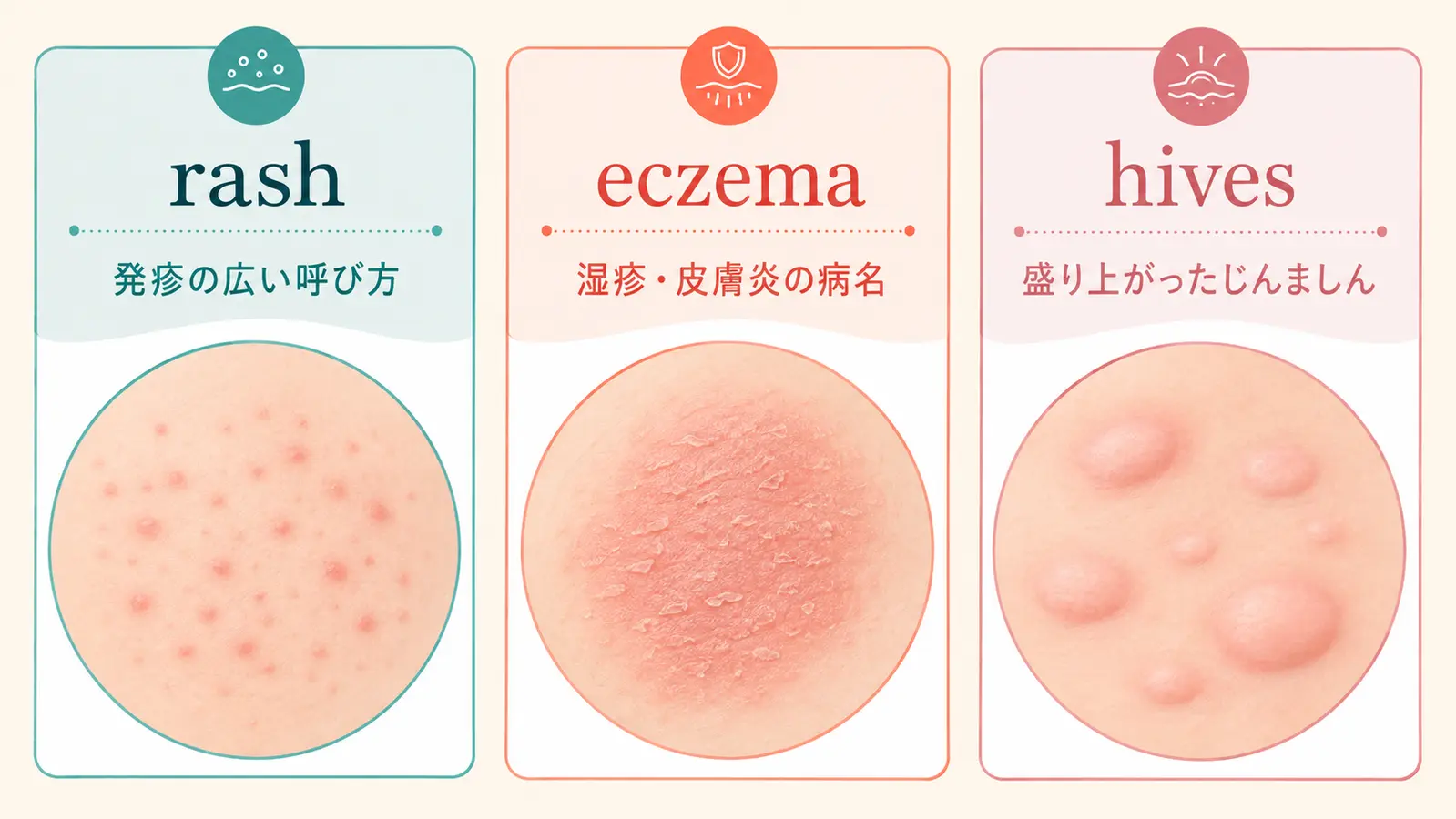 rashは発疹の広い呼び方、eczemaは湿疹、hivesはじんましんという違い