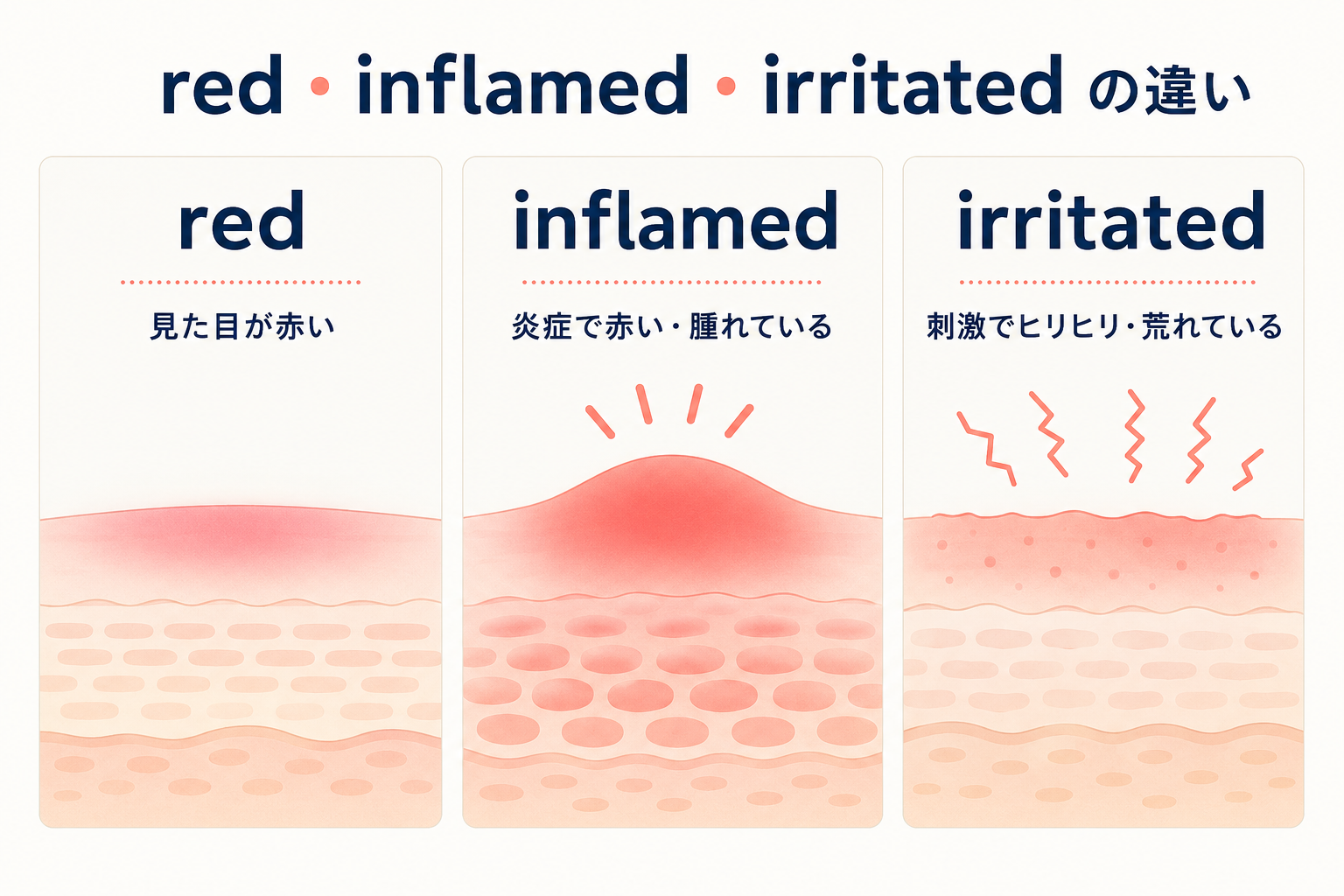 redは見た目が赤い、inflamedは炎症、irritatedは刺激による肌荒れを表す比較図