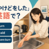 熱湯で腕にやけどをし流水で冷やしながら救急連絡を頼む旅行者