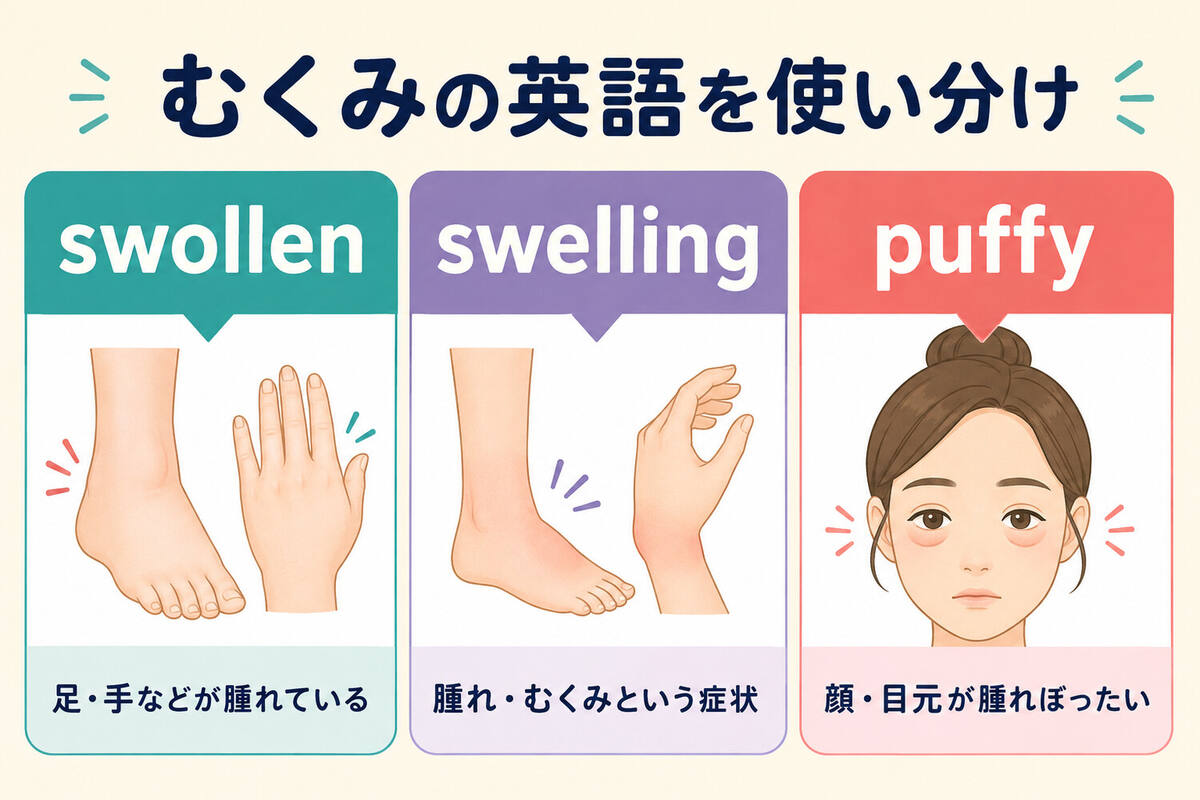 swollen・swelling・puffyの違いを足・手・顔で示す比較図